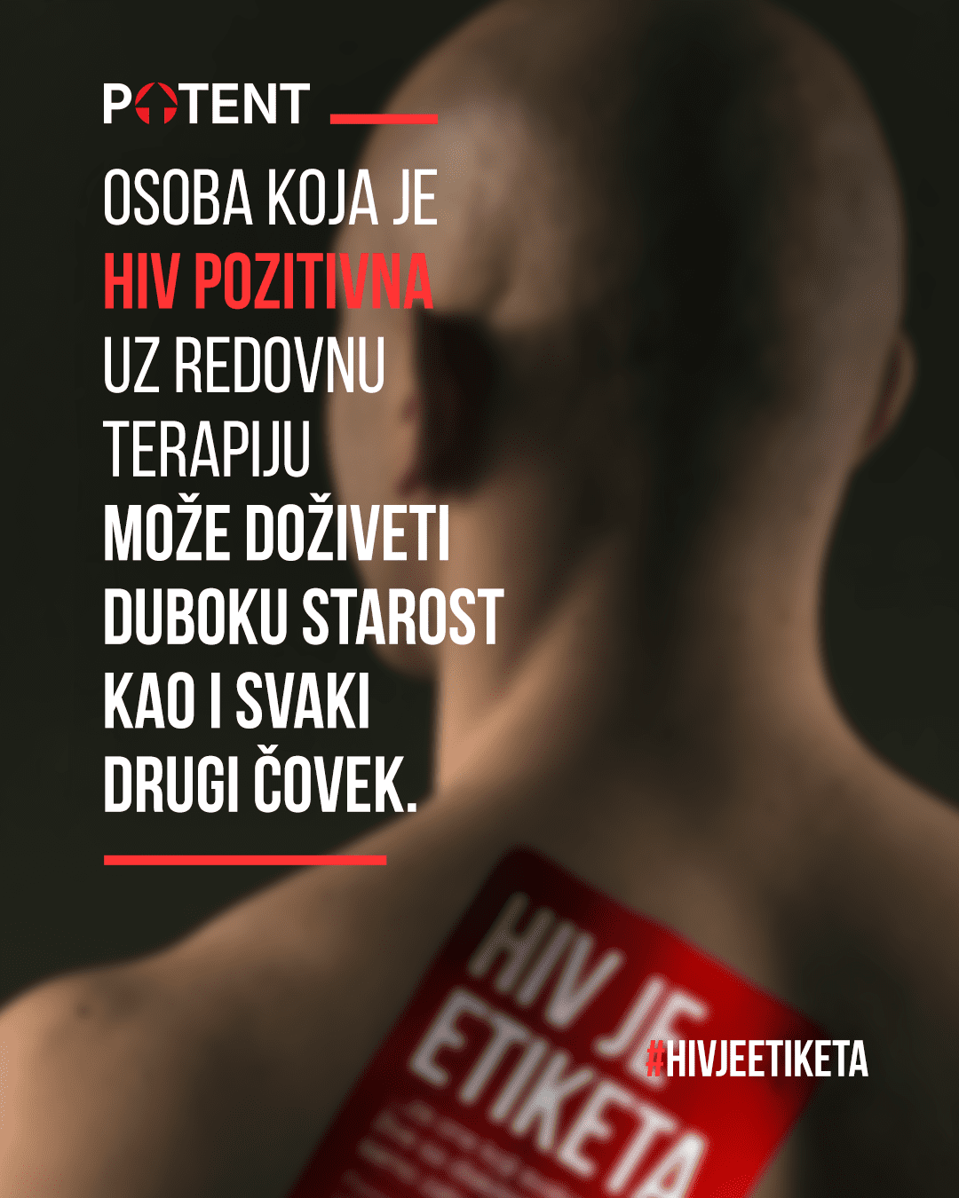 "HIV je etiketa"