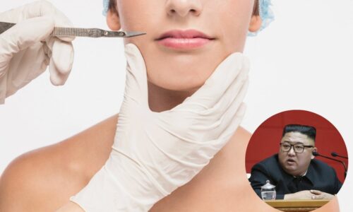 Plastične operacije, Kim Džong Un