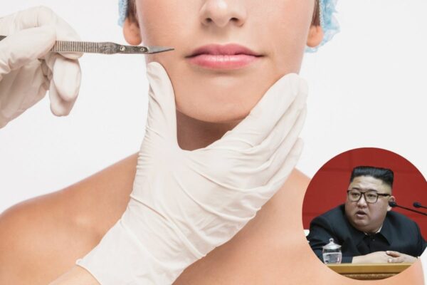 Plastične operacije, Kim Džong Un