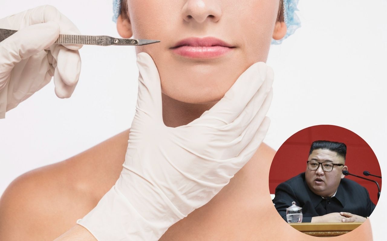 Plastične operacije, Kim Džong Un